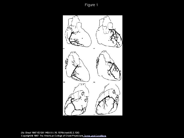 Figure 1 Dis Chest 1967 52125 -140 DOI: (10. 1378/chest. 52. 2. 125) Copyright