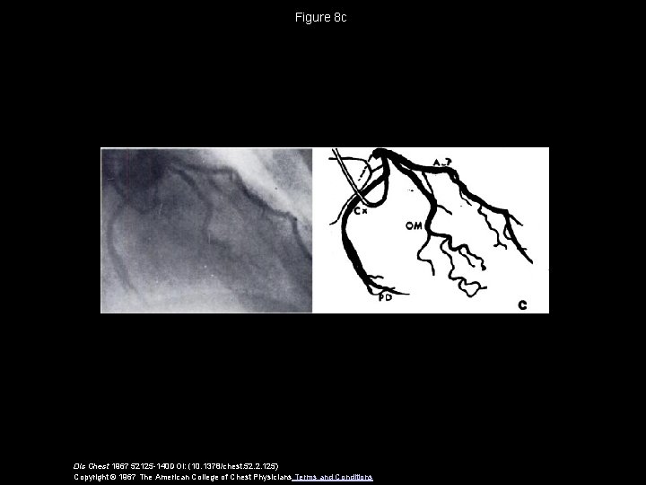 Figure 8 c Dis Chest 1967 52125 -140 DOI: (10. 1378/chest. 52. 2. 125)