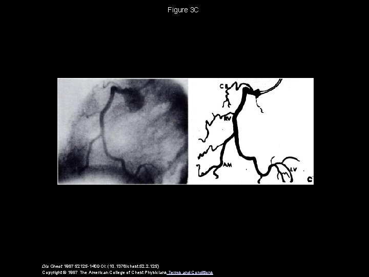 Figure 3 C Dis Chest 1967 52125 -140 DOI: (10. 1378/chest. 52. 2. 125)