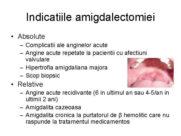 Indicatiile amigdalectomiei • Absolute – Complicatii ale anginelor acute – Angine acute repetate la