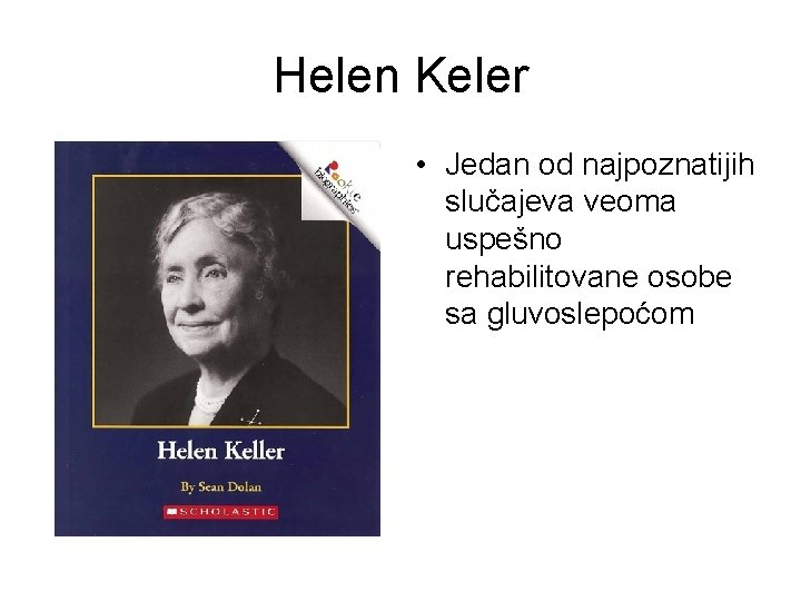 Helen Keler • Jedan od najpoznatijih slučajeva veoma uspešno rehabilitovane osobe sa gluvoslepoćom 