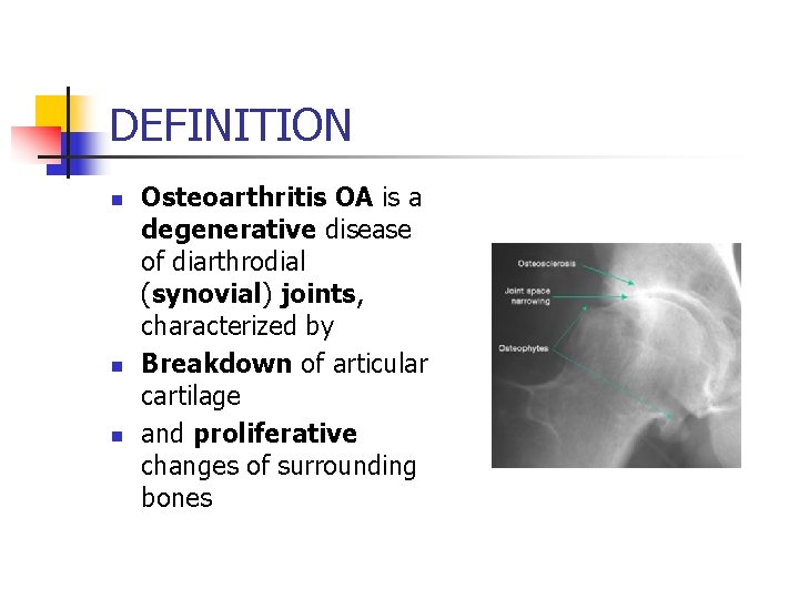 DEFINITION n n n Osteoarthritis OA is a degenerative disease of diarthrodial (synovial) joints,