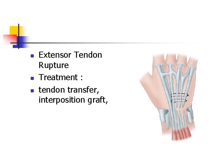 n n n Extensor Tendon Rupture Treatment : tendon transfer, interposition graft, 