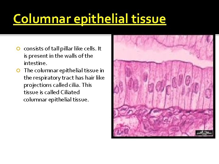 Columnar epithelial tissue consists of tall pillar like cells. It is present in the