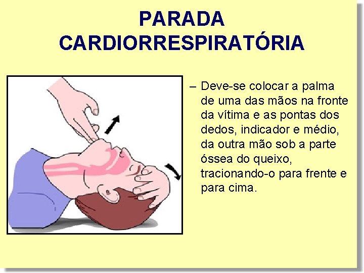 PARADA CARDIORRESPIRATÓRIA – Deve-se colocar a palma de uma das mãos na fronte da PARADA CARDIORRESPIRATÓRIA – Deve-se colocar a palma de uma das mãos na fronte da
