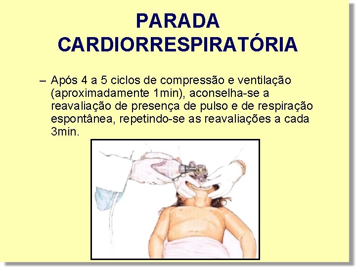 PARADA CARDIORRESPIRATÓRIA – Após 4 a 5 ciclos de compressão e ventilação (aproximadamente 1 PARADA CARDIORRESPIRATÓRIA – Após 4 a 5 ciclos de compressão e ventilação (aproximadamente 1