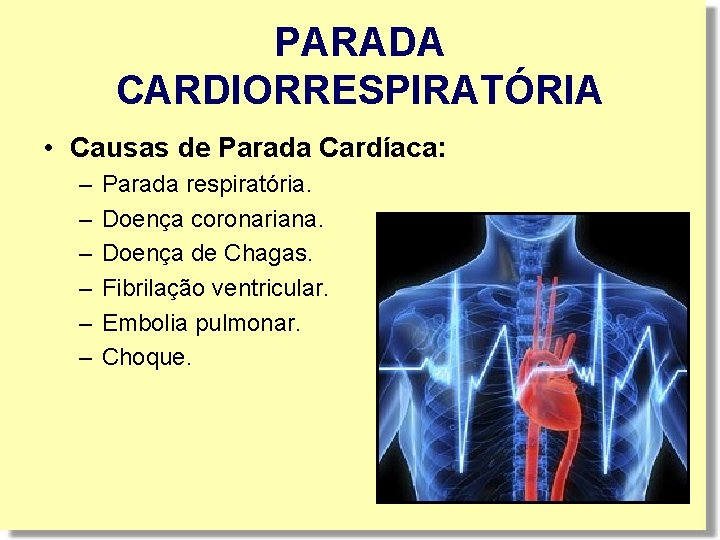 PARADA CARDIORRESPIRATÓRIA • Causas de Parada Cardíaca: – – – Parada respiratória. Doença coronariana. PARADA CARDIORRESPIRATÓRIA • Causas de Parada Cardíaca: – – – Parada respiratória. Doença coronariana.