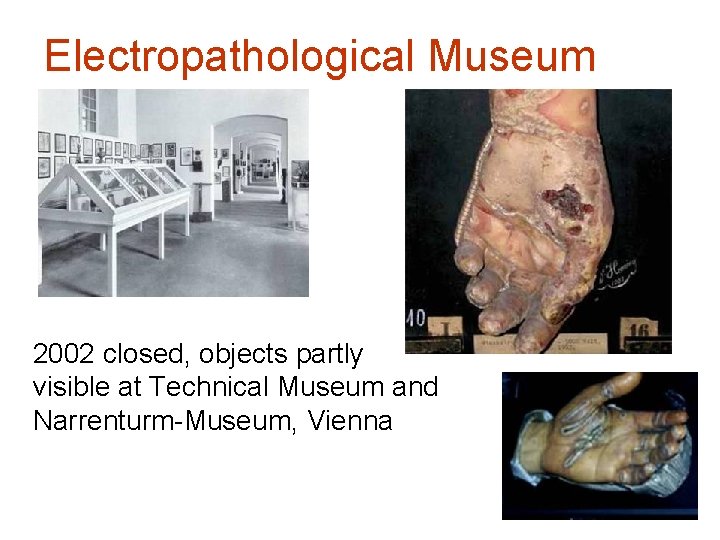 Electropathological Museum 2002 closed, objects partly visible at Technical Museum and Narrenturm-Museum, Vienna 