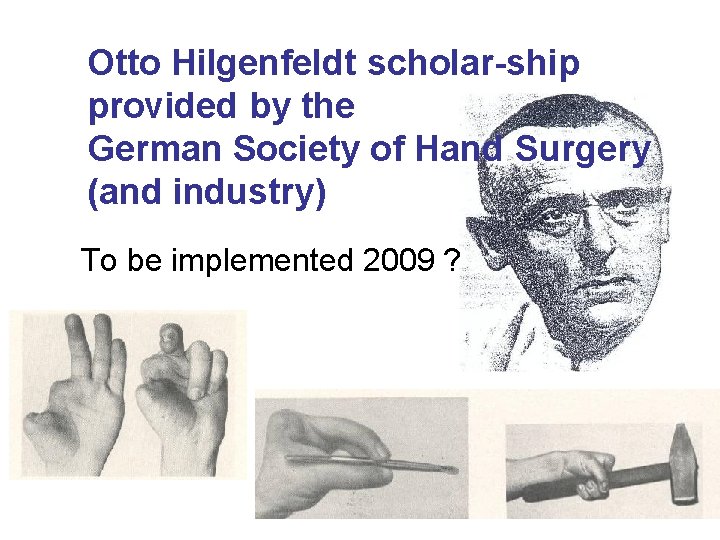 Otto Hilgenfeldt scholar-ship provided by the German Society of Hand Surgery (and industry) To