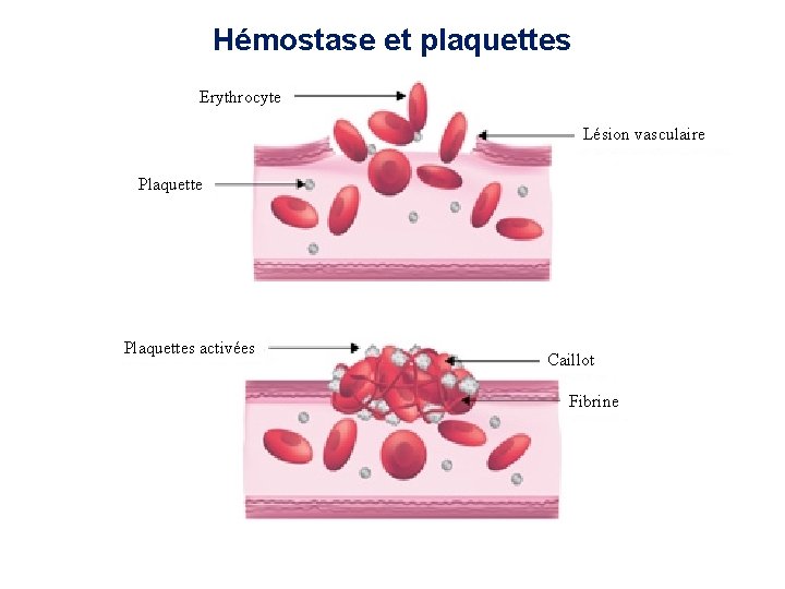 Hémostase et plaquettes Erythrocyte Lésion vasculaire Plaquettes activées Caillot Fibrine 