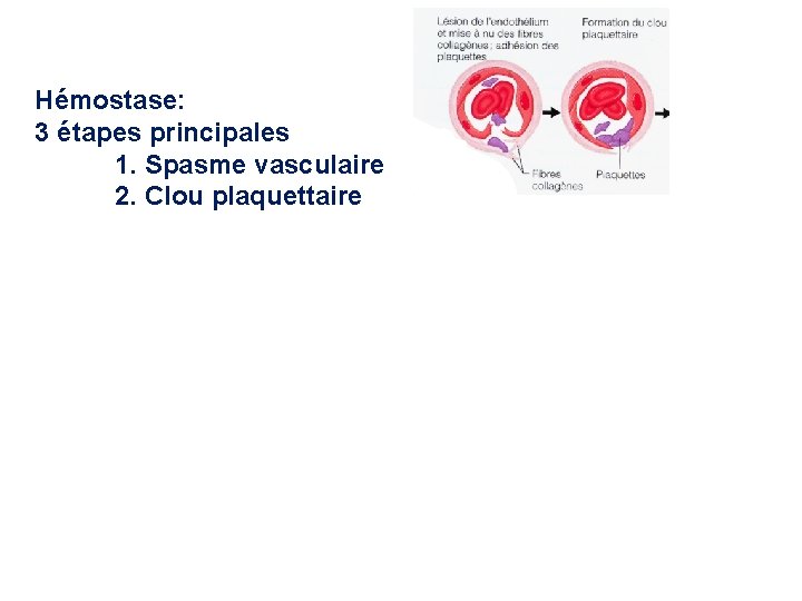 Hémostase: 3 étapes principales 1. Spasme vasculaire 2. Clou plaquettaire 