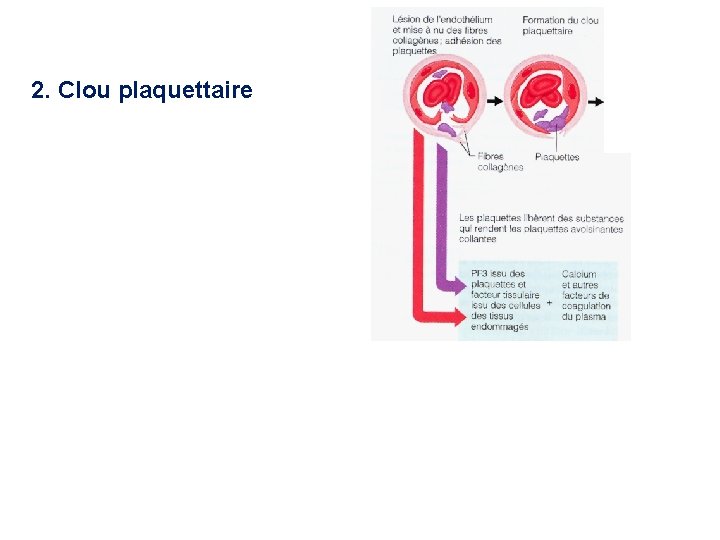 2. Clou plaquettaire 