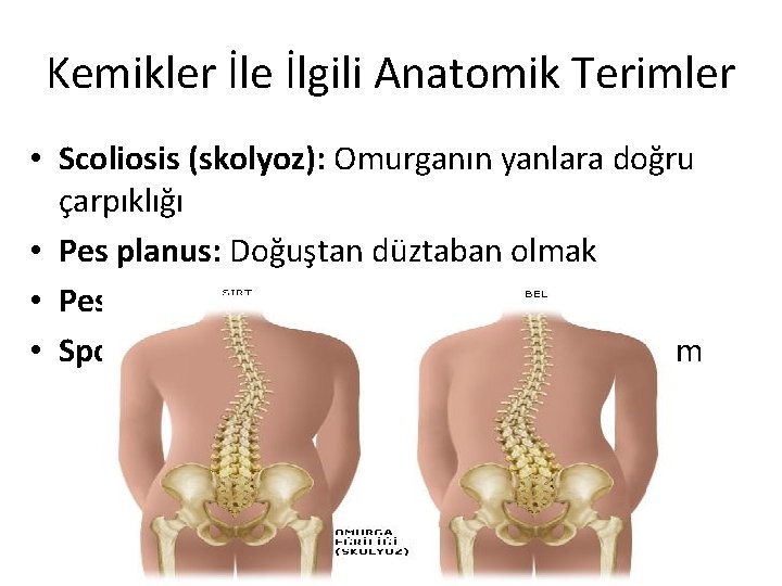 Kemikler İle İlgili Anatomik Terimler • Scoliosis (skolyoz): Omurganın yanlara doğru çarpıklığı • Pes