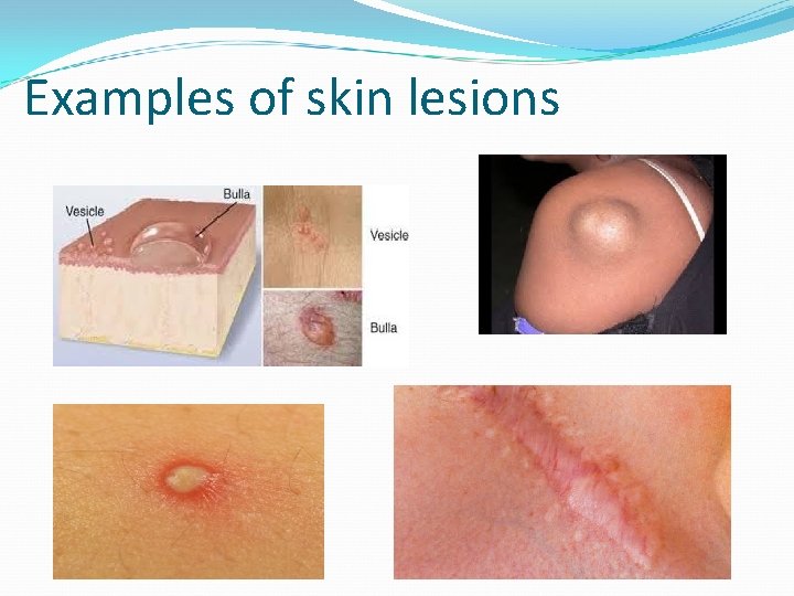 Examples of skin lesions 