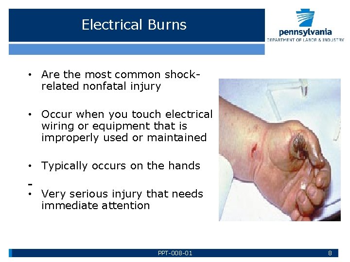 Electrical Burns • Are the most common shockrelated nonfatal injury • Occur when you