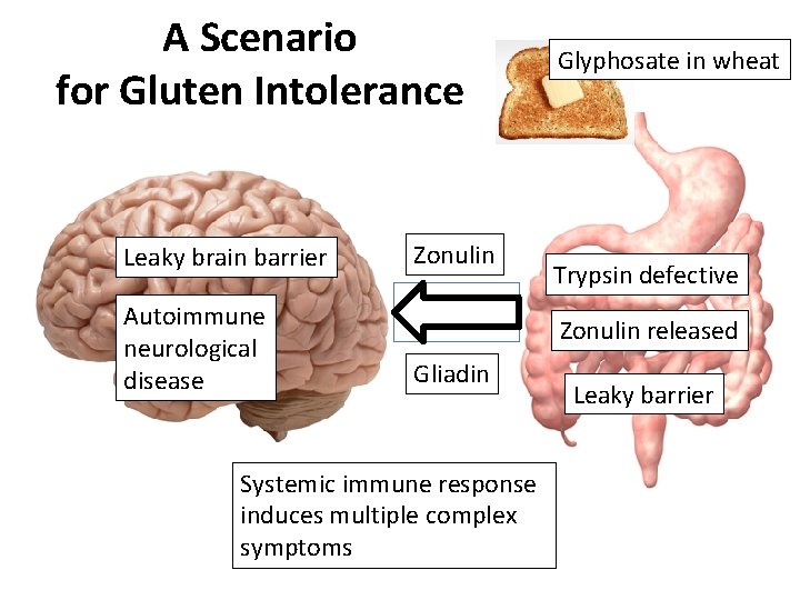 A Scenario for Gluten Intolerance Leaky brain barrier Autoimmune neurological disease Zonulin Glyphosate in