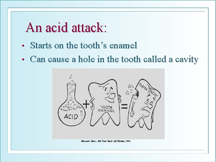 An acid attack: Starts on the tooth’s enamel • Can cause a hole in