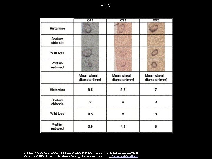 Fig 5 Journal of Allergy and Clinical Immunology 2006 1181176 -1183 DOI: (10. 1016/j.