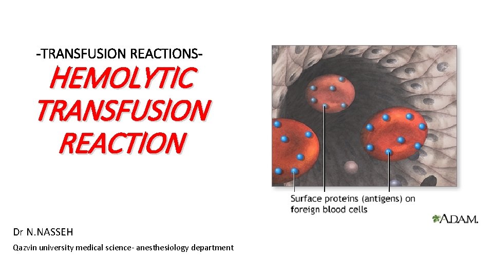 -TRANSFUSION REACTIONS- HEMOLYTIC TRANSFUSION REACTION Dr N. NASSEH Qazvin university medical science- anesthesiology department