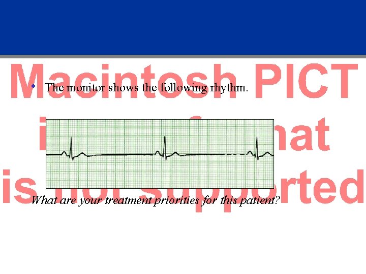  • The monitor shows the following rhythm. What are your treatment priorities for