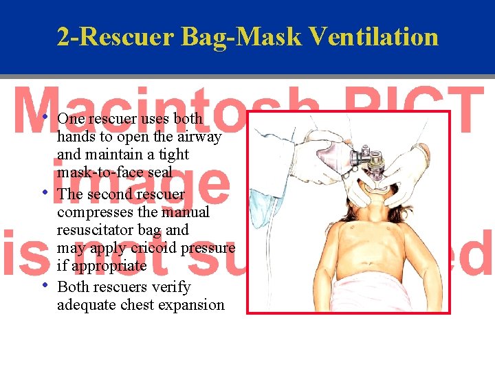 2 -Rescuer Bag-Mask Ventilation • • • One rescuer uses both hands to open