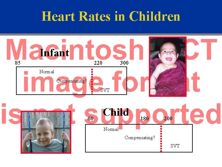 Heart Rates in Children Infant 85 220 300 Normal Compensating? SVT 60 Child 180
