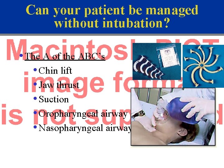 Can your patient be managed without intubation? • The A of the ABC’s •
