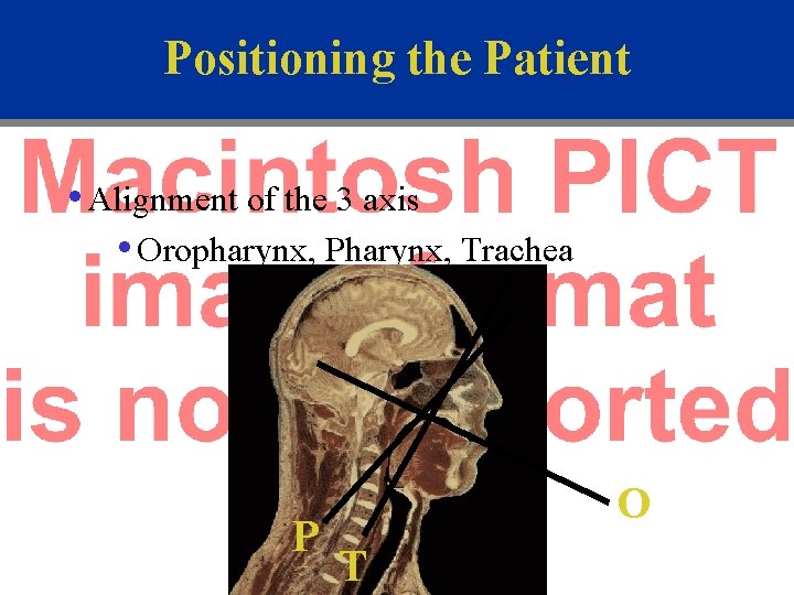 Positioning the Patient • Alignment of the 3 axis • Oropharynx, Pharynx, Trachea P