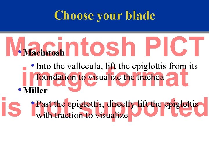 Choose your blade • Macintosh • Into the vallecula, lift the epiglottis from its