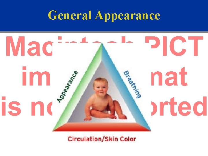 General Appearance 
