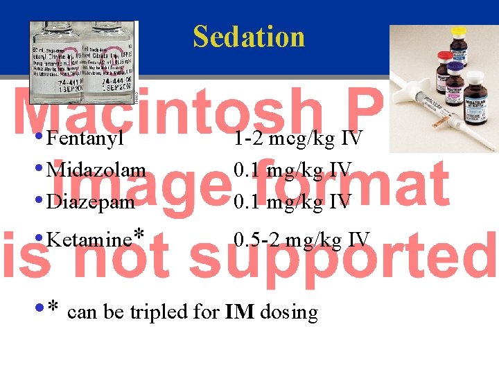 Sedation • Fentanyl • Midazolam • Diazepam • Ketamine* 1 -2 mcg/kg IV 0.