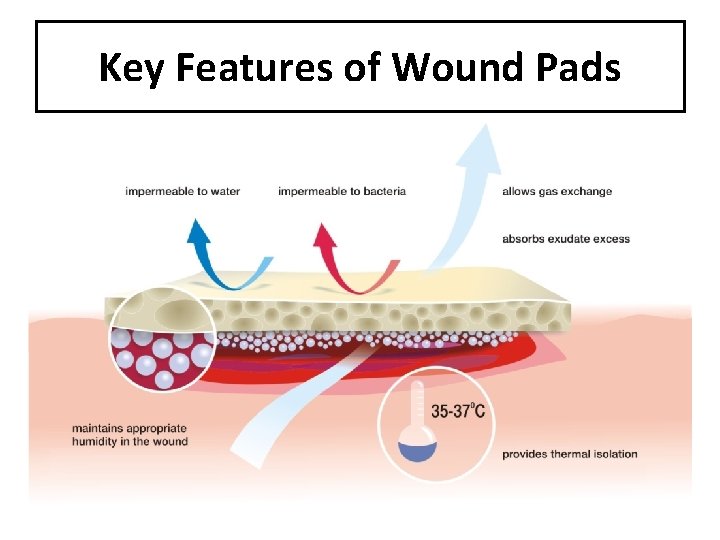 Key Features of Wound Pads 