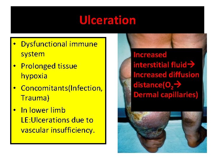 Ulceration • Dysfunctional immune system • Prolonged tissue hypoxia • Concomitants(Infection, Trauma) • In