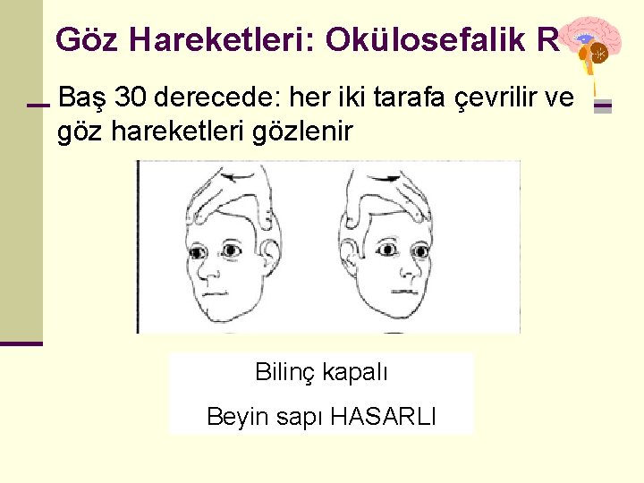 Göz Hareketleri: Okülosefalik R Baş 30 derecede: her iki tarafa çevrilir ve göz hareketleri