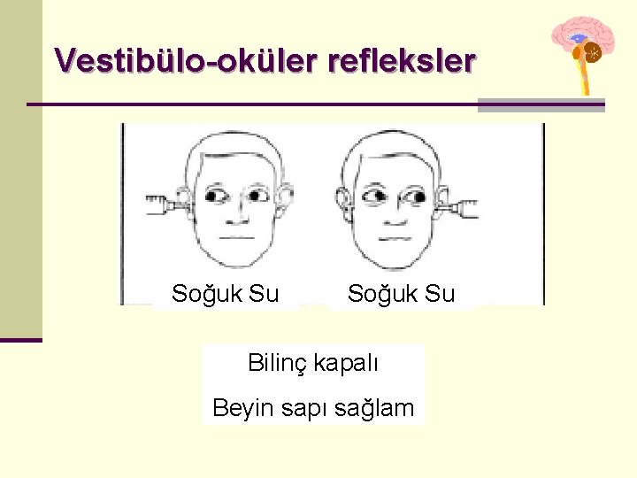 Vestibülo-oküler refleksler Soğuk Su Bilinç kapalı Beyin sapı sağlam Vestibülo-oküler refleksler Soğuk Su Bilinç kapalı Beyin sapı sağlam