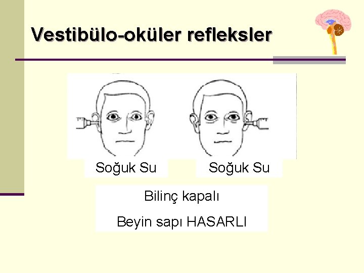 Vestibülo-oküler refleksler Soğuk Su Bilinç kapalı Beyin sapı HASARLI Vestibülo-oküler refleksler Soğuk Su Bilinç kapalı Beyin sapı HASARLI