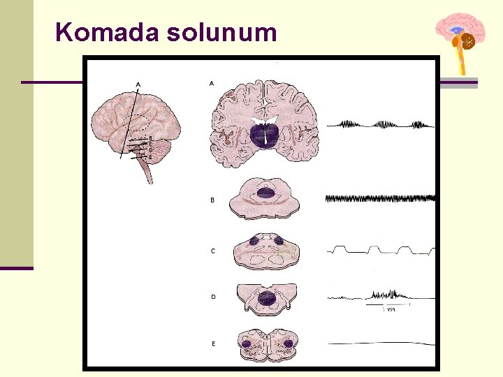 Komada solunum İstanbul, Kasım 2011 