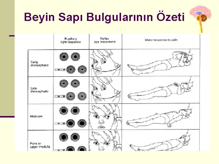 Beyin Sapı Bulgularının Özeti Beyin Sapı Bulgularının Özeti