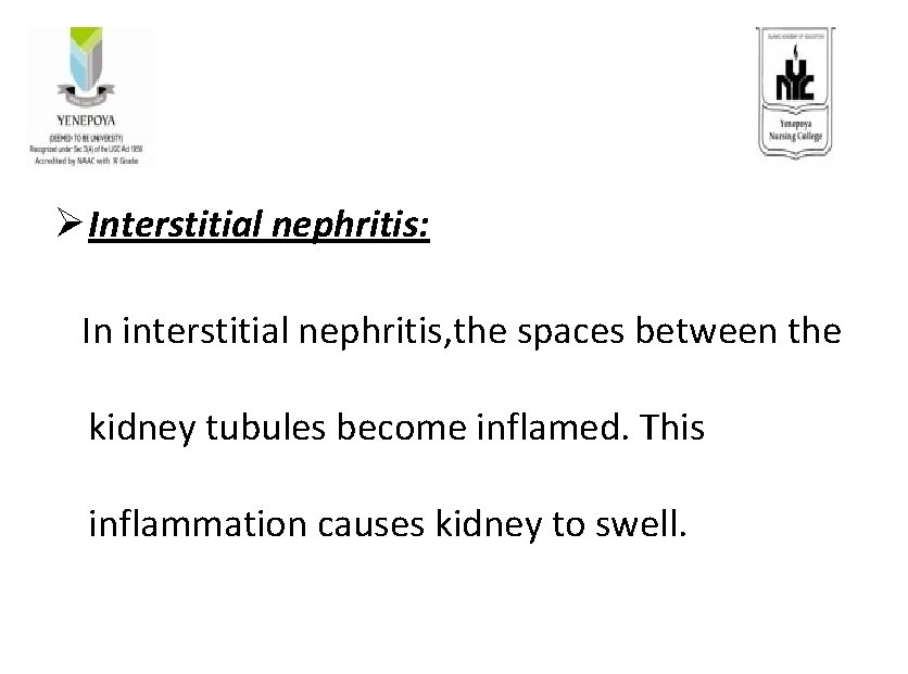 Ø Interstitial nephritis: In interstitial nephritis, the spaces between the kidney tubules become inflamed. Ø Interstitial nephritis: In interstitial nephritis, the spaces between the kidney tubules become inflamed.