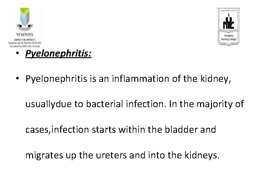 • Pyelonephritis: • Pyelonephritis is an inflammation of the kidney, usuallydue to bacterial • Pyelonephritis: • Pyelonephritis is an inflammation of the kidney, usuallydue to bacterial