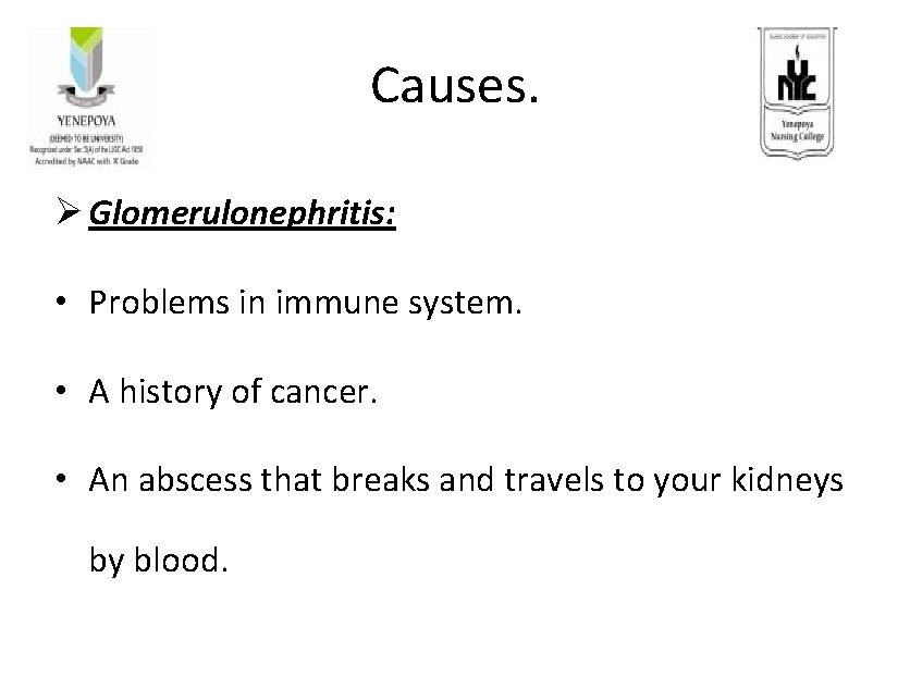 Causes. Ø Glomerulonephritis: • Problems in immune system. • A history of cancer. • Causes. Ø Glomerulonephritis: • Problems in immune system. • A history of cancer. •