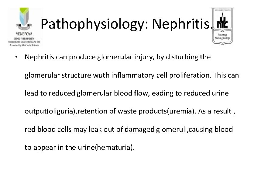 Pathophysiology: Nephritis. • Nephritis can produce glomerular injury, by disturbing the glomerular structure wuth Pathophysiology: Nephritis. • Nephritis can produce glomerular injury, by disturbing the glomerular structure wuth