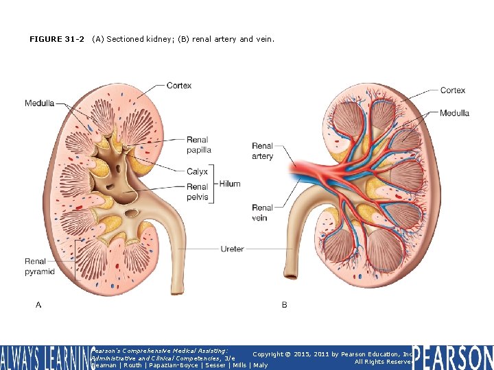 FIGURE 31 -2 (A) Sectioned kidney; (B) renal artery and vein. Pearson's Comprehensive Medical