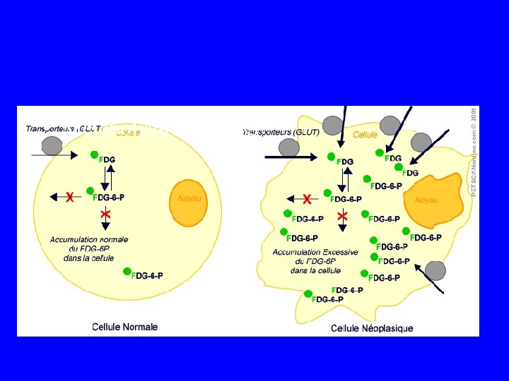  • Métabolisme du FDG 