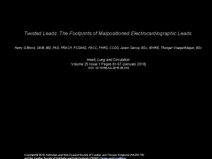 Twisted Leads: The Footprints of Malpositioned Electrocardiographic Leads Harry G Mond, OAM, MD, Ph.