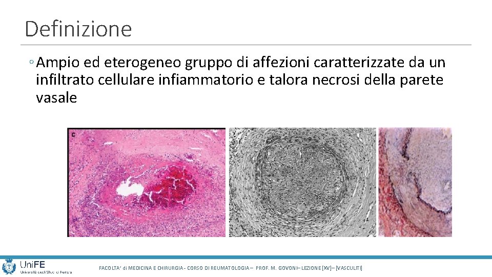 Definizione ◦ Ampio ed eterogeneo gruppo di affezioni caratterizzate da un infiltrato cellulare infiammatorio Definizione ◦ Ampio ed eterogeneo gruppo di affezioni caratterizzate da un infiltrato cellulare infiammatorio