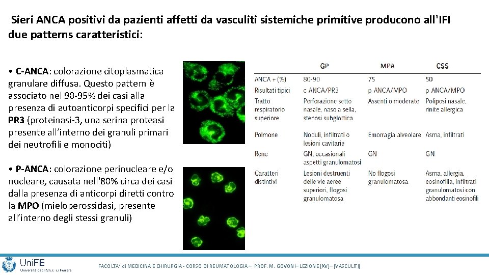Sieri ANCA positivi da pazienti affetti da vasculiti sistemiche primitive producono all'IFI due Sieri ANCA positivi da pazienti affetti da vasculiti sistemiche primitive producono all'IFI due