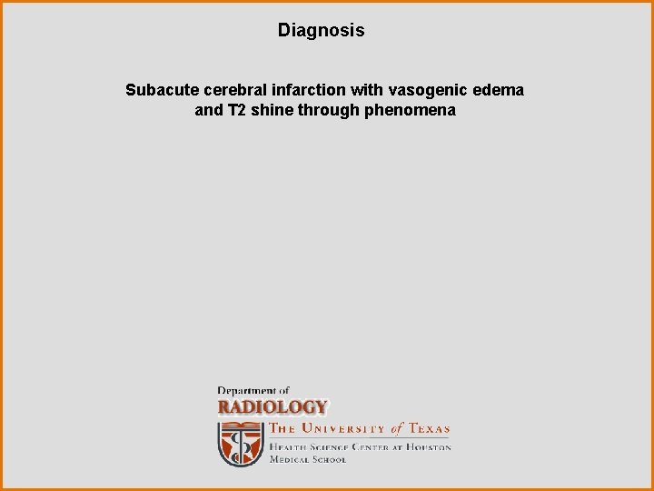 Diagnosis Subacute cerebral infarction with vasogenic edema and T 2 shine through phenomena Diagnosis Subacute cerebral infarction with vasogenic edema and T 2 shine through phenomena