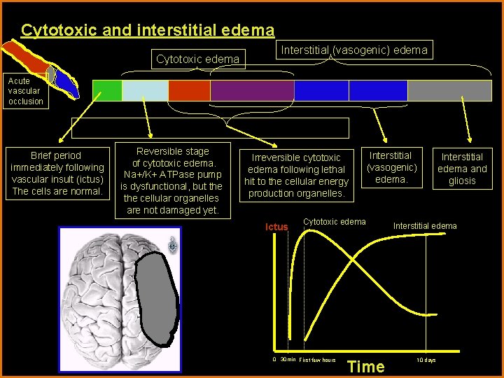Cytotoxic and interstitial edema Cytotoxic edema Interstitial (vasogenic) edema Acute vascular occlusion Brief period Cytotoxic and interstitial edema Cytotoxic edema Interstitial (vasogenic) edema Acute vascular occlusion Brief period