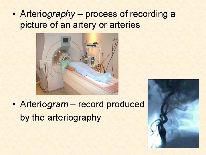  • Arteriography – process of recording a picture of an artery or arteries